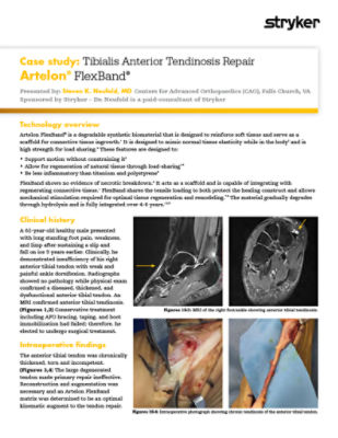 Case study: Tibialis Anterior Tendinosis Repair