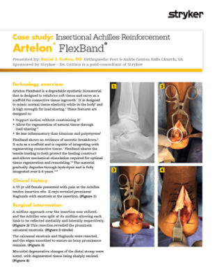 Case study: Insertional Achilles Reinforcement
