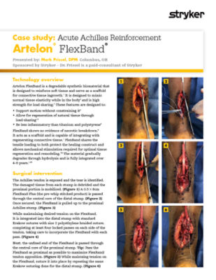 Case study: Acute Achilles Reinforcement 