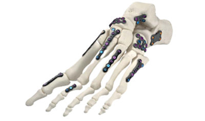 Variax 2 foot Product image