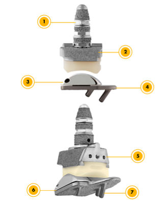 Invision total ankle replacement system - ankle revision