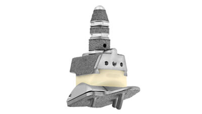 Invision Total Ankle Revision System - total ankle replacement surgery