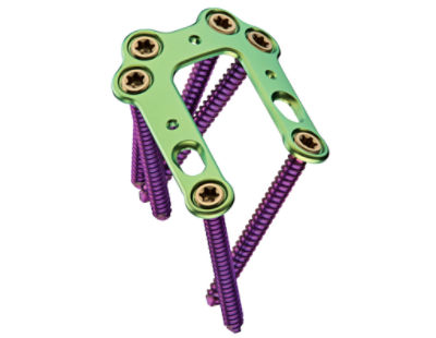FA-Ortho-3DI-Foot-Recon-U-plate-02