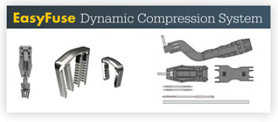 EasyFuse® Dynamic Compression System