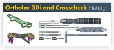 Ortholoc® 3Di and Crosscheck Plating