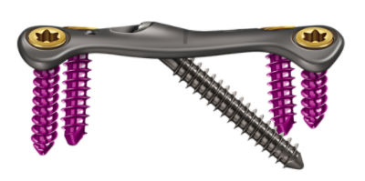 HERO_Ortholoc 2 Crosscheck_MTPOblique