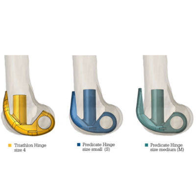 Femoral sizing