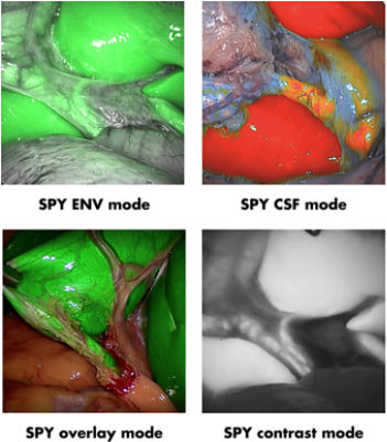 Fluorescence Imaging