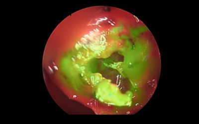 Fluorescence imaging