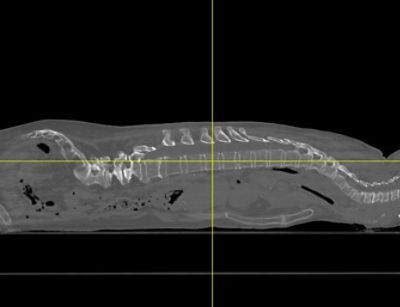 Full Spine Sagittal