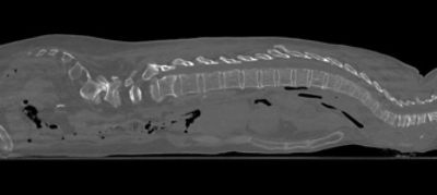 Full Spine Sagittal 1