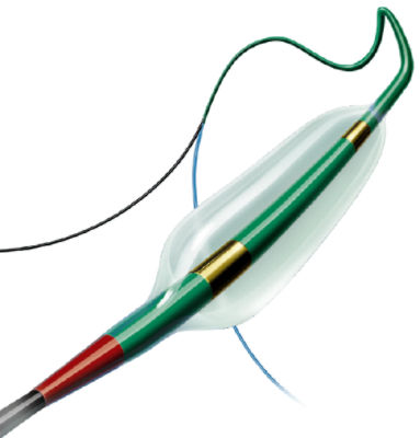 GatewayMonorailPTABalloonCatheter_01