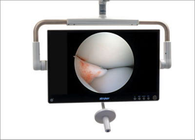 4K 32 inch OLED surgical monitor showcasing anatomy