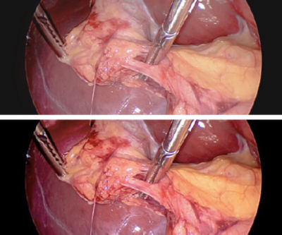 4K 32 surgical display