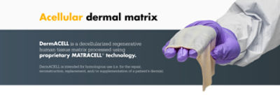 Acellular Dermal Matrix