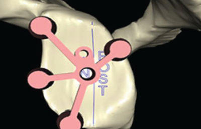 Guided accuracy for the OR