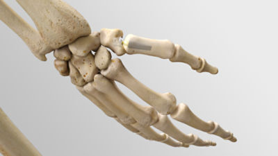 Hand & Wrist advanced course