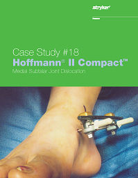 Hoffmann II Compact Medial Subtalar Joint Dislocation