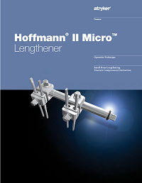 Hoffmann Micro Lengthener Operative Technique
