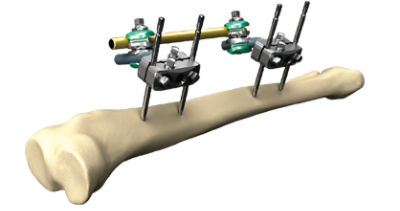Hoffmann 3