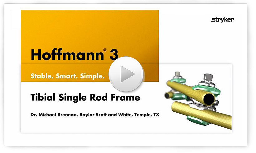 Tibial Single Rod Frame sawbone demonstration