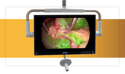 4K 32 inch OLED surgical monitor showcasing anatomy