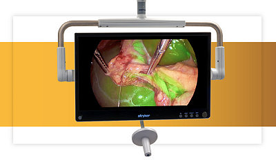 4K 32 inch OLED surgical monitor showcasing anatomy