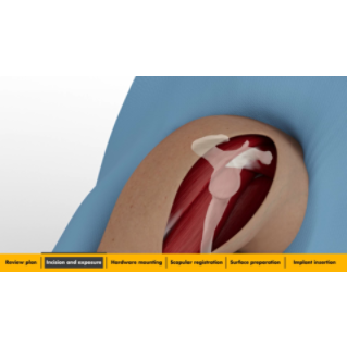 Mako Shoulder workflow animation