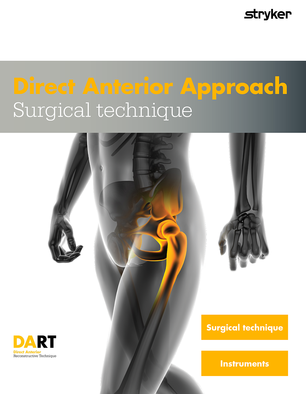 Direct Anterior Approach Surgical Technique