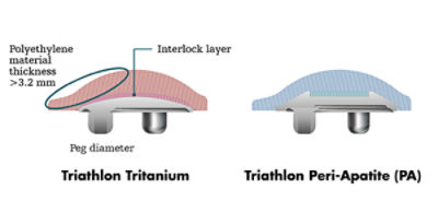 JR-Knee-Triathlon-Cementless-Hero-image02