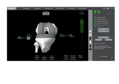 Mako Total Knee 2.0 Digital Tensioner