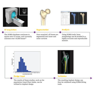 Total Hip Replacement, Anterior Approach (Accolade® II)