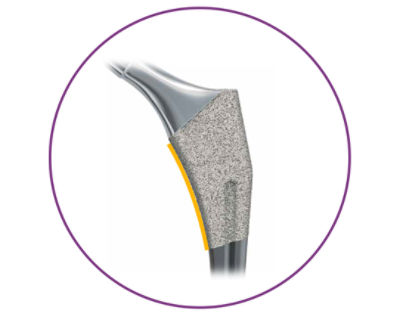 Unique size-specific medial curvature