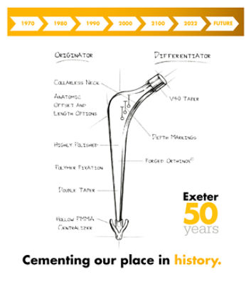 Total Hip replacement(posterior approach): Cemented Exeter