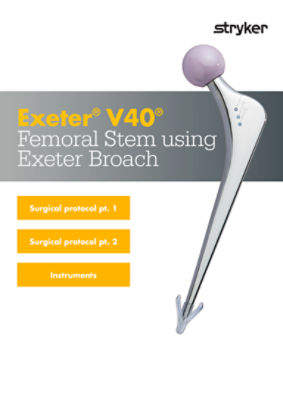 Total Hip replacement(posterior approach): Exeter femoral stem and  Tritanium acetabular component (Stryker) Surgical Technique - OrthOracle