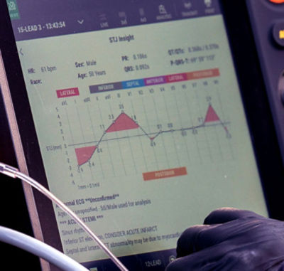 LIFEPAK 35 showing STJInsight on large touchscreen