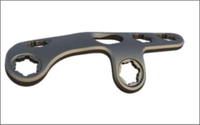 Lapifuse_Transmetatarsal