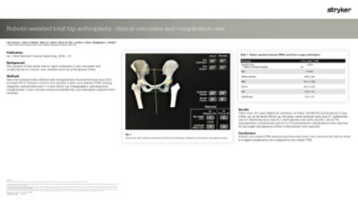 Robotic-assisted total hip arthoplasty: clinical outcomes and complication rate