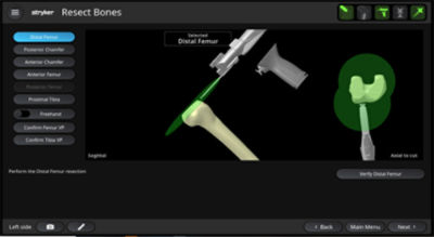 Mako RPS bone resection software screen