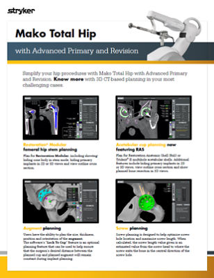 Mako Total Hip with Advanced Primary and Revision sell sheet