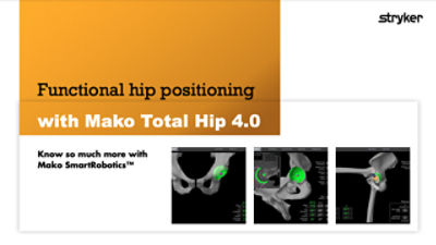 Mako Total Hip SmartRobotics™ - Functional hip positioning with Mako Total Hip 4.0