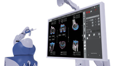 Mako Total Knee alongside CT image of knee