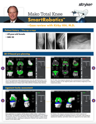 Mako Total Knee SmartRobotics™ - Case review with Dr. Kirby Hitt