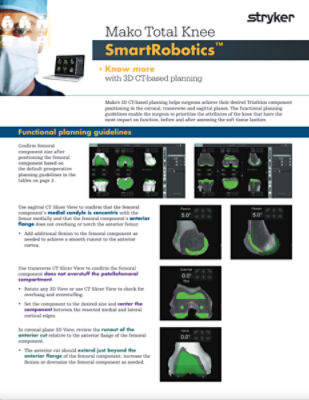 Mako Total Knee SmartRobotics™ - Functional planning guidelines