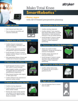 Mako Total Knee SmartRobotics™ - Know more with 3D CT-based preoperative planning