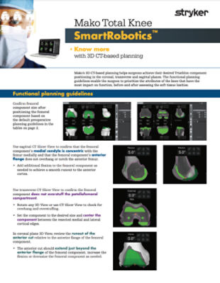 Mako Total Knee SmartRobotics™ Functional planning guidelines