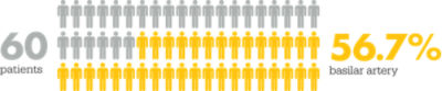Y Stenting results: 60 patients; 56.7 basil artery