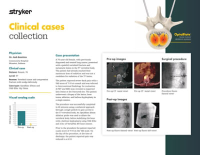 Clinical case demonstrating 76-year-old patient outcome with vertebral tumor and compression fracture using OptaBlate bone tumor ablation system