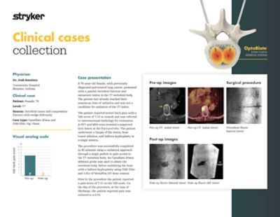A 76-year-old female, with previously diagnosed and treated lung cancer, presented with a painful vertebral fracture and metastatic lesion in the T7 vertebral body