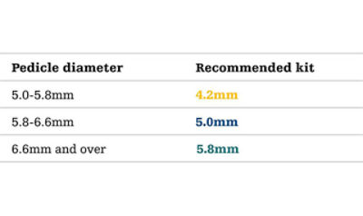 Optimal implant fit chart for SpineJack procedure